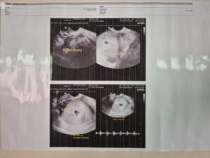 Mark Daniel Lanaria Wife Pregnant